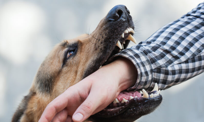 A dog bites man on the hand