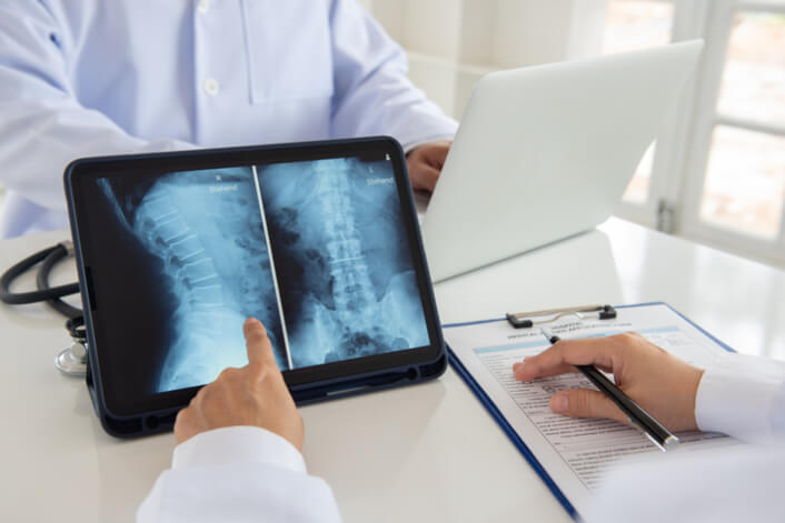Two medical doctors review scan images for spinal cord injury